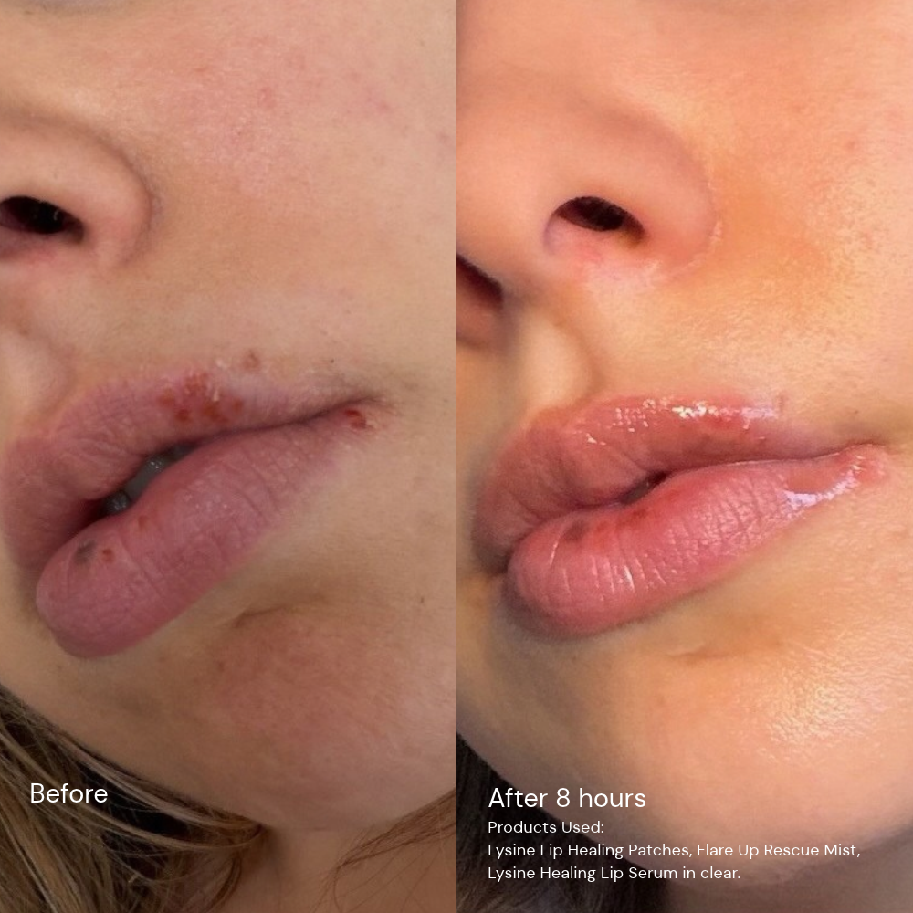 Lysine Healing Lip Serum