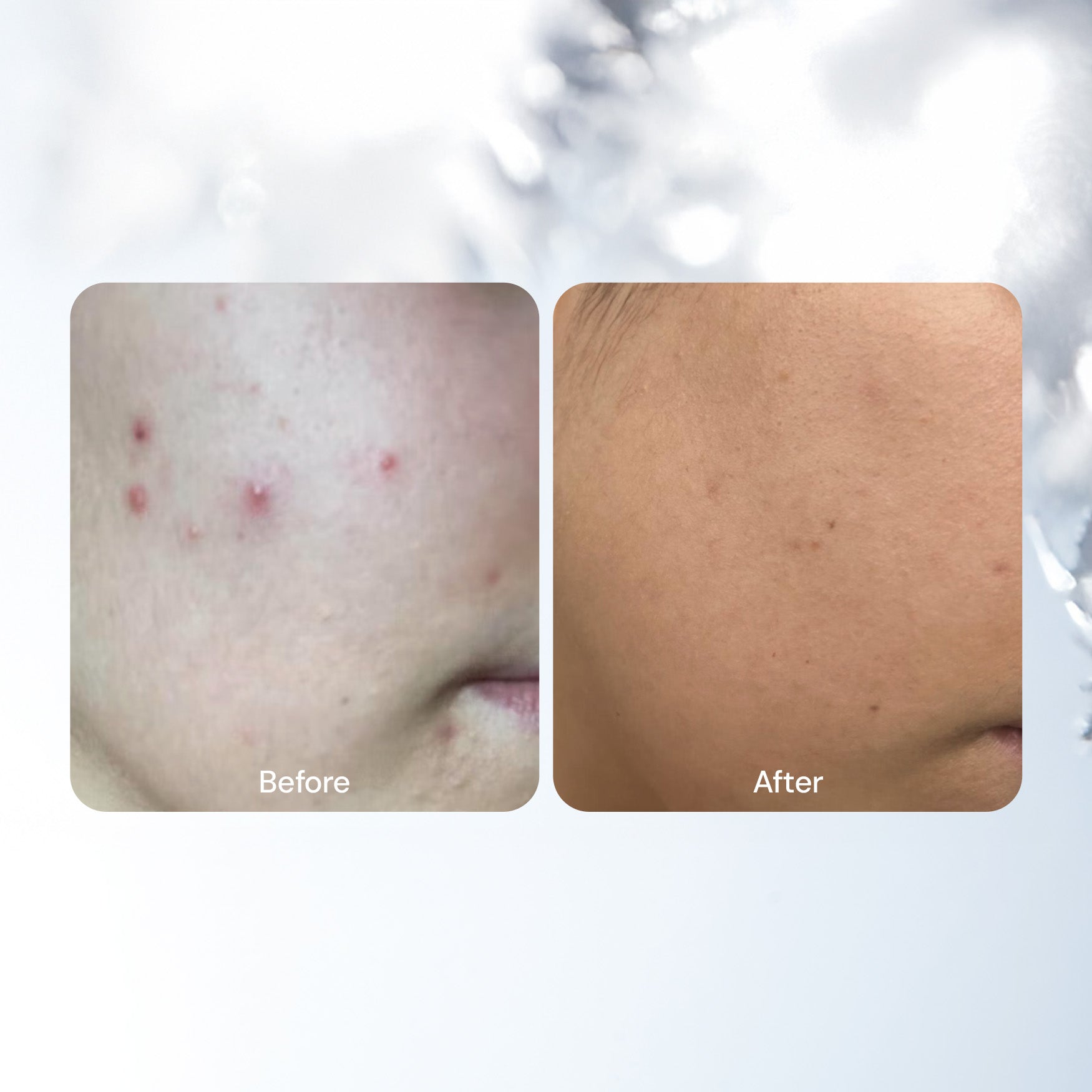 Blemish-Fighting Spot Dots