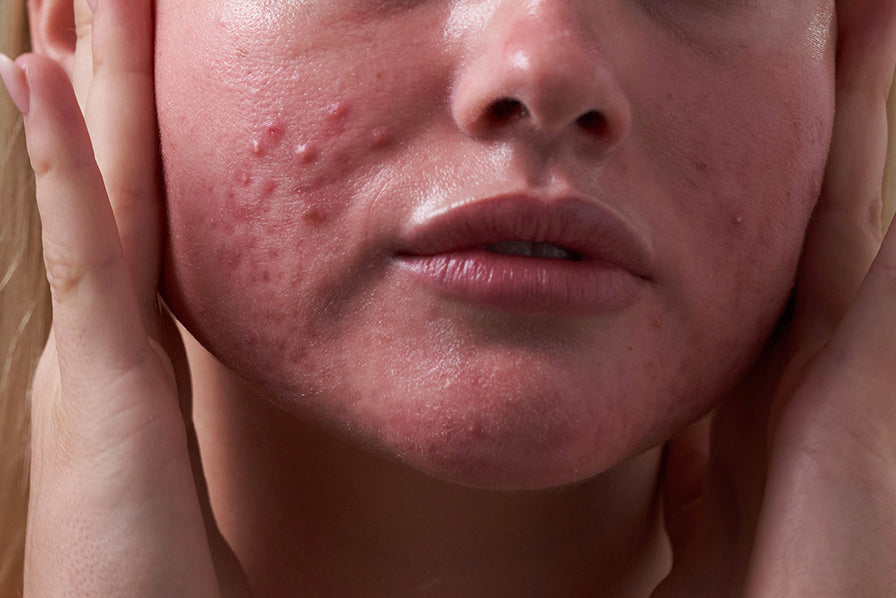 Sensitive Skin Isn't Difficult - It's Been Given the Wrong Products