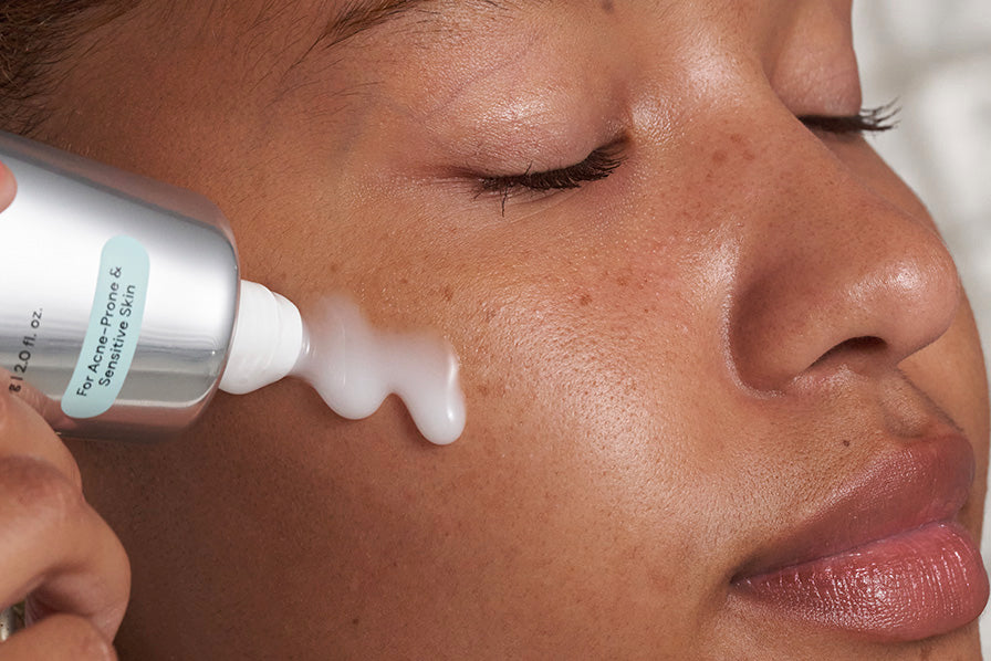 Why Acne-Prone Skin Still Needs Moisture - It Just Needs the Right Kind