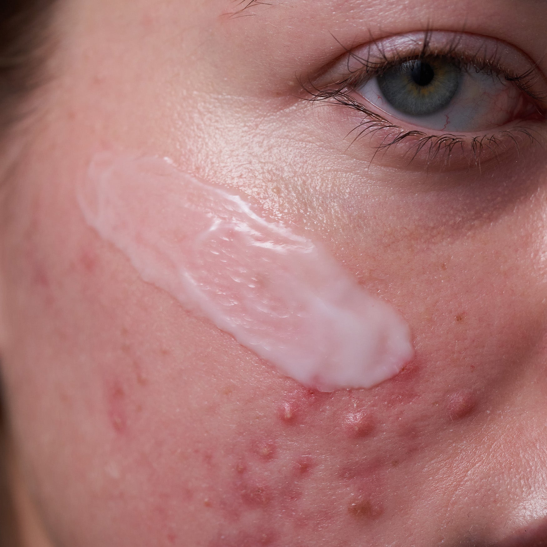 CICAcalm™ Clarifying Moisturizer