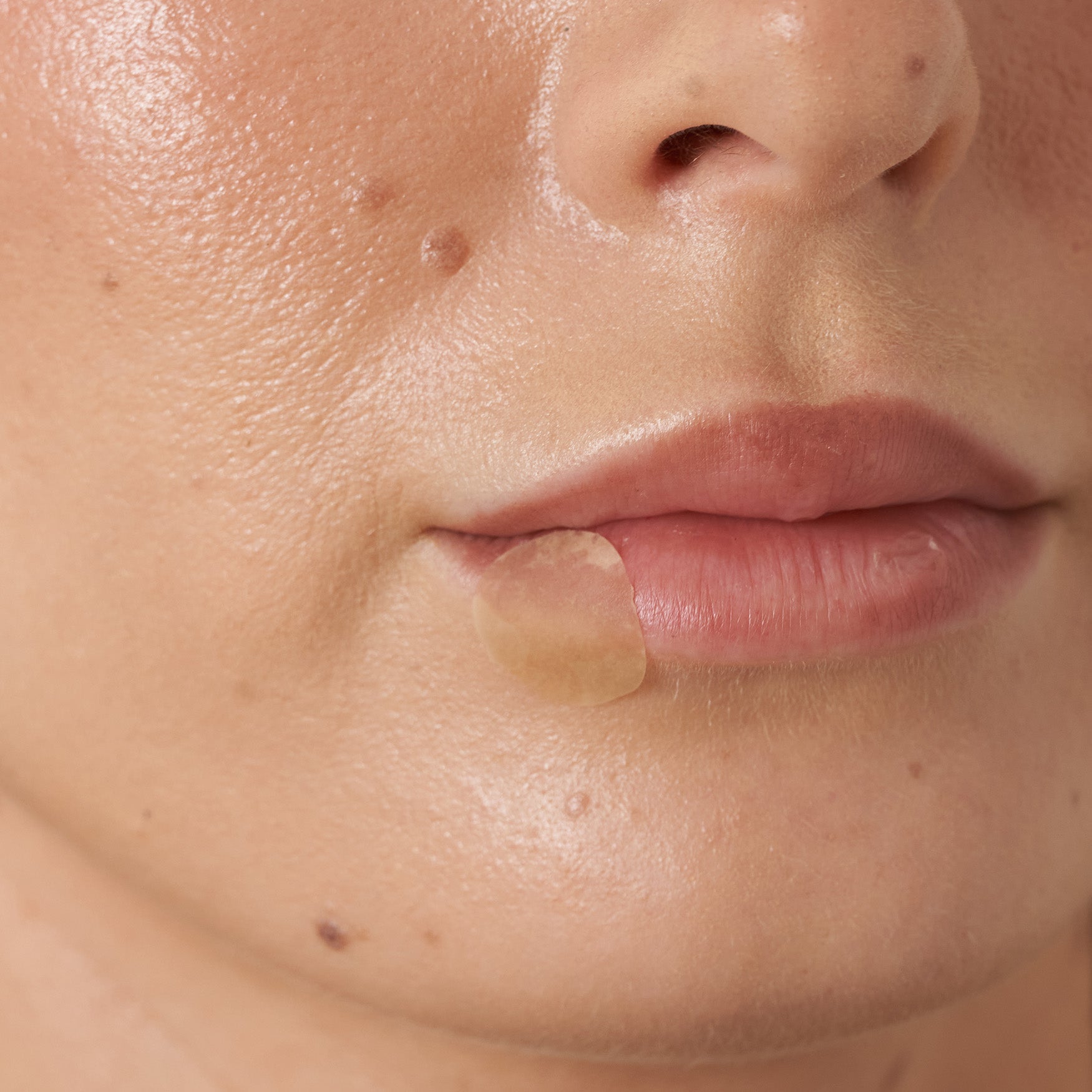 Lysine Lip Healing Patches