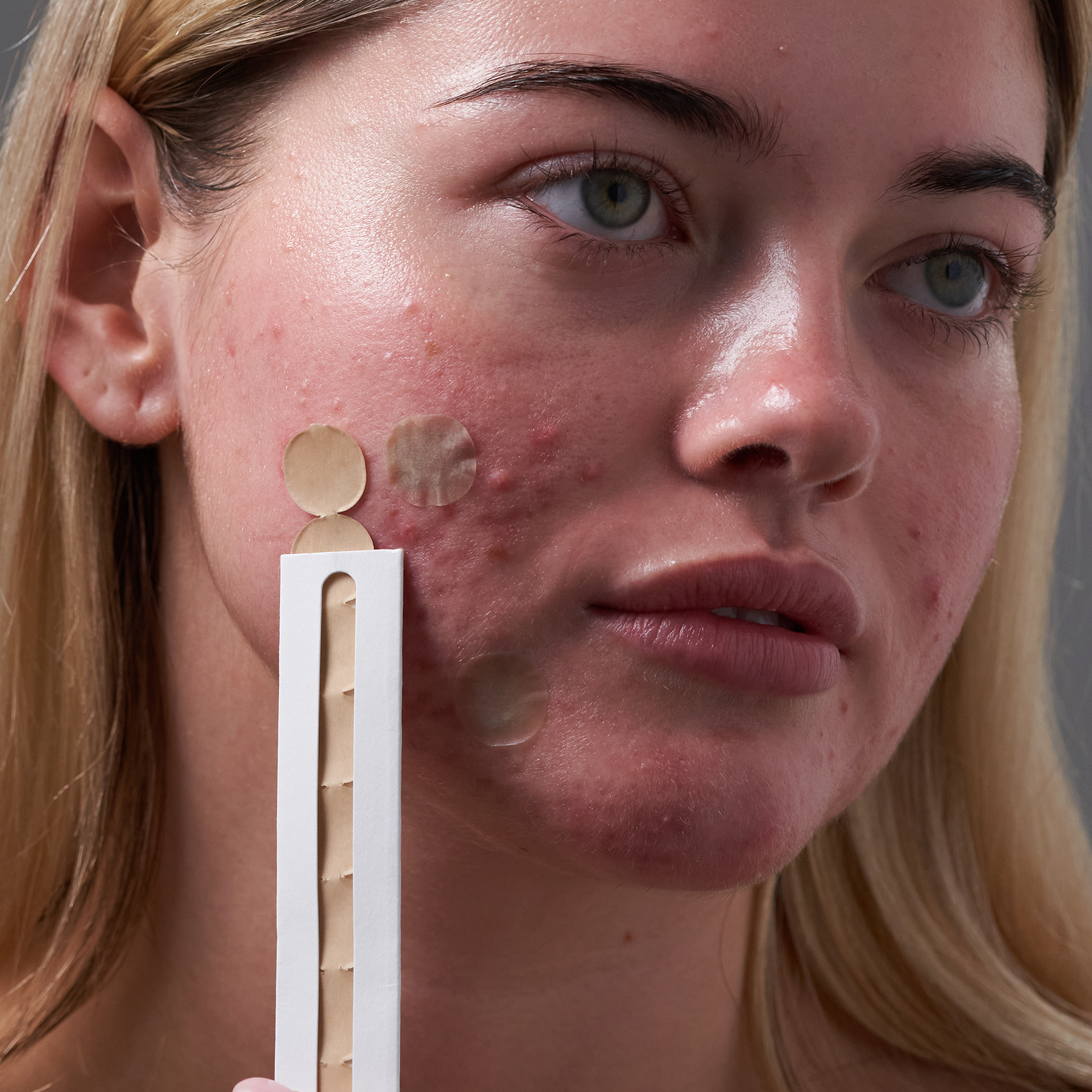 Blemish-Fighting Spot Dots