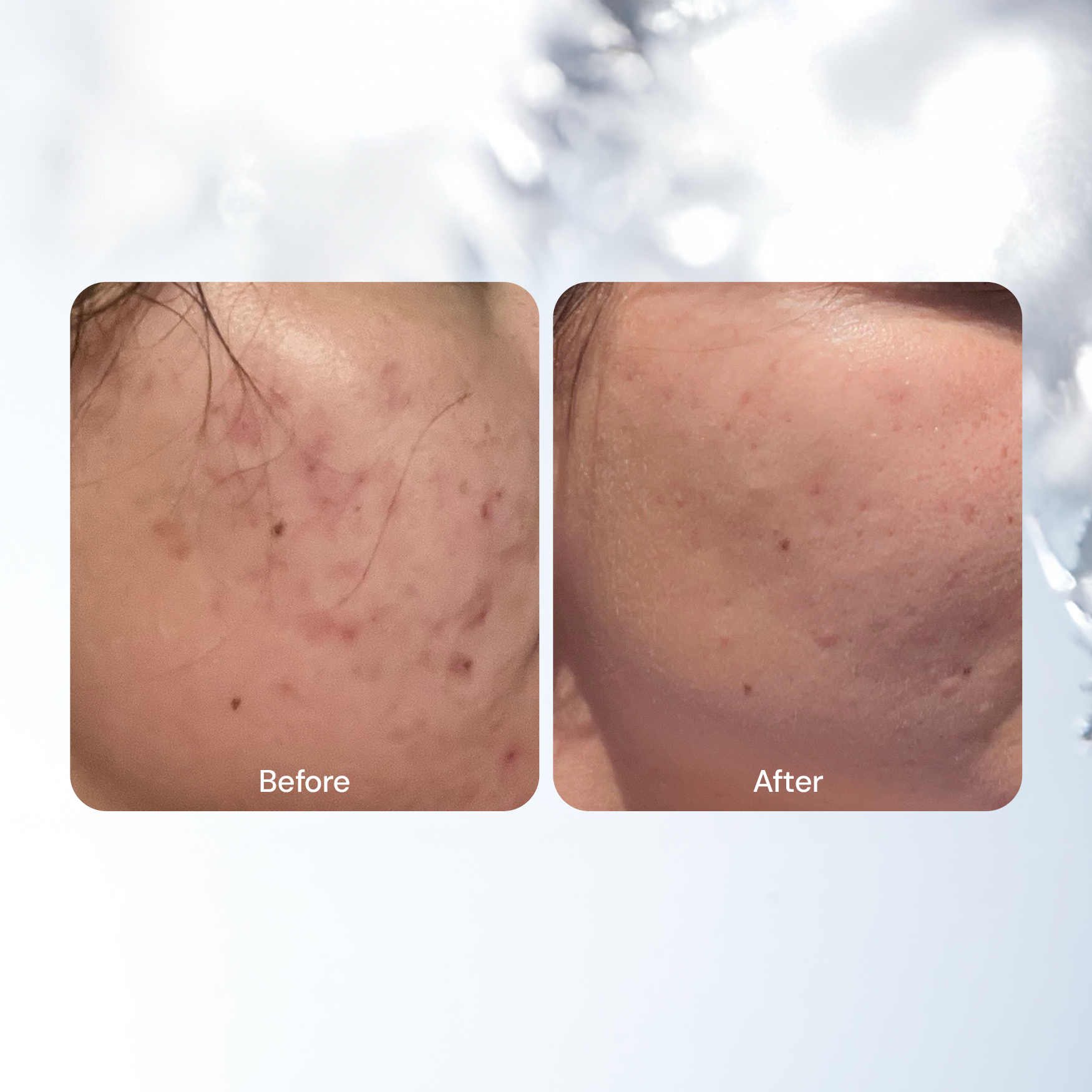 Blemish-Fighting Spot Dots